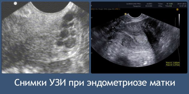 Коли прийдуть місячні після скасування Візану