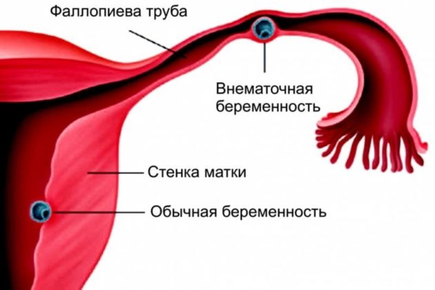 Місячні почалися на тиждень раніше