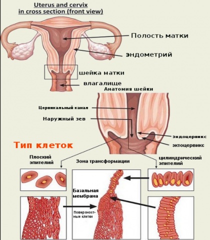 Що таке плоскоклеточная метаплазия