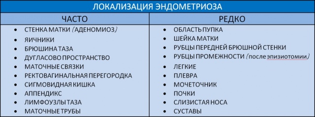 Що таке ендометріоїдна кіста шийки матки