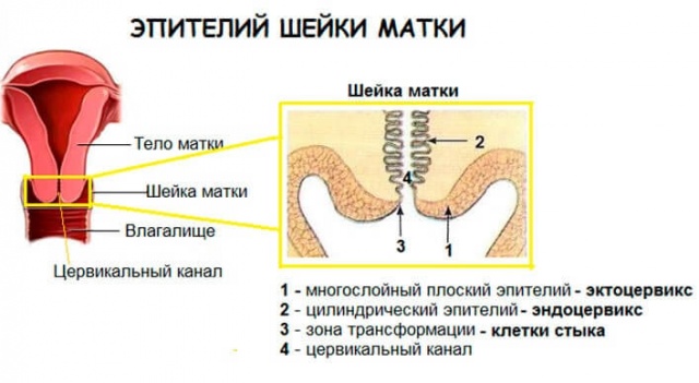 Розшифровка онкоцитологію шийки матки