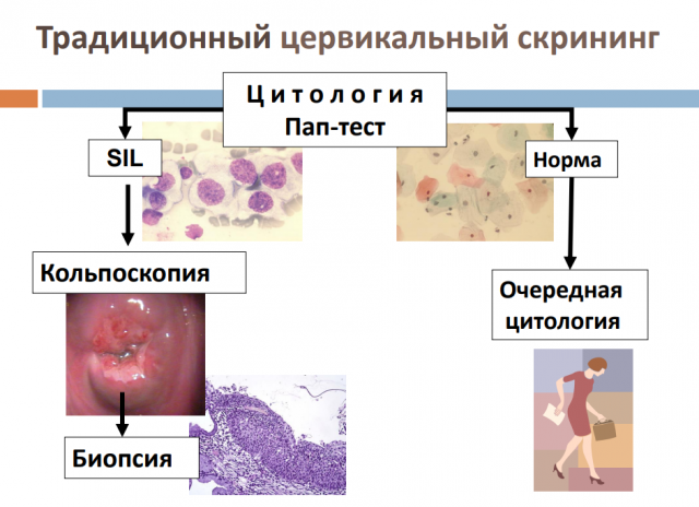 Аналіз на онкоцитологию