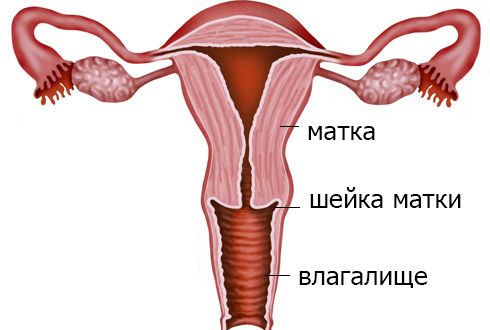 Лікування кісти в матці