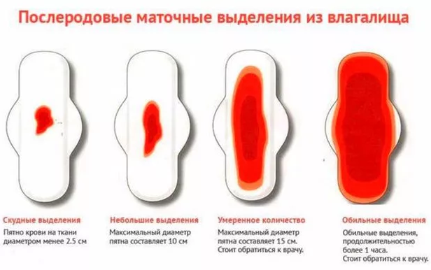 Як розпізнати маткова кровотеча