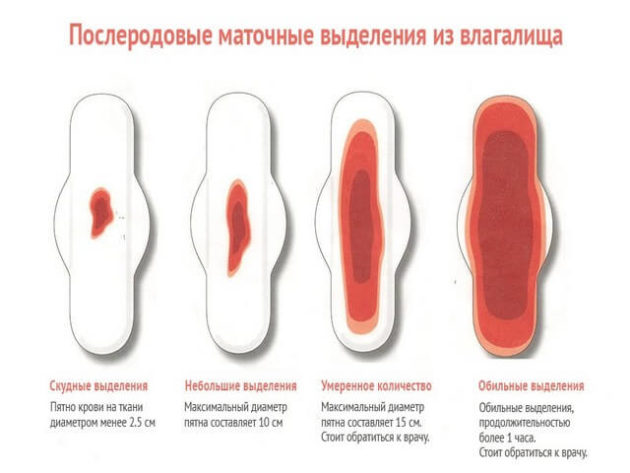 Місячні після кесаревого розтину