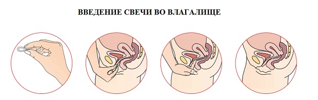 Свічки Ливарол від молочниці