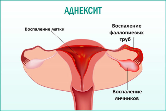 Здуття живота перед місячними