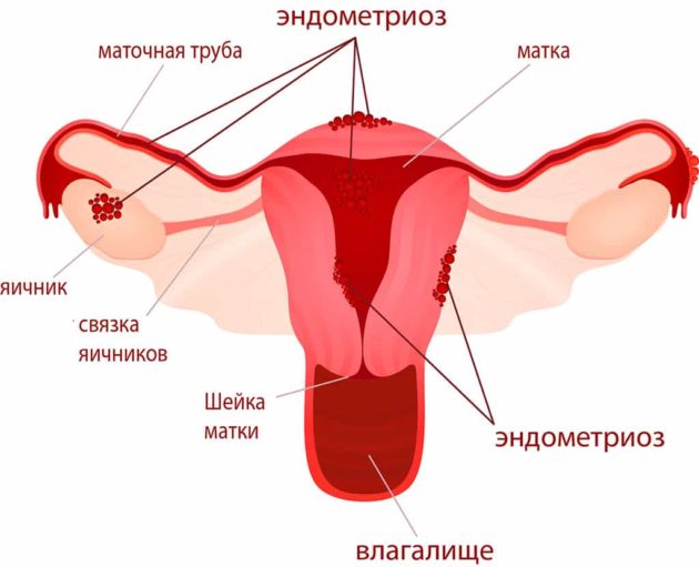 Виділення перед місячними