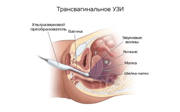 Мазанина замість місячних